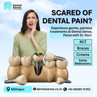 Dental Sense | best dentist in patna