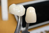 Braces & Aligners Treatment in Thoothukudi | Top Orthodontist