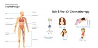 Dos and Don’ts in Chemotherapy | Chemotherapy in Delhi