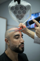 Clion Care – Advanced Hair & Scalp Clinic in Ahmedabad