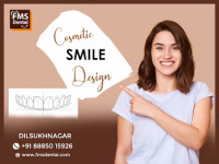 Best Smile Designing Dental Clinic in Dilsukhnagar- FMS Dental Clinic - Dilsukhnagar