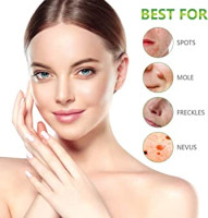 Clear Tag Skin Tag Remover Reviews [Best Skin Tag Remover] Shark Tank Skin Tag Remover Warning?