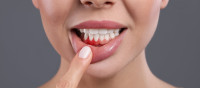Bleeding Gum Treatment in Bhandara