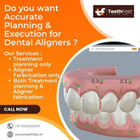 Best Dental Lab in Indore – TeethFast