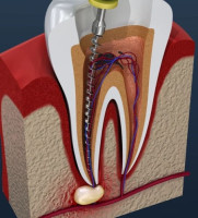 Dantah Dental The Best Dental Clinic in Gangapur Road, Nashik