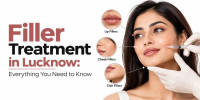 Filler Treatment in Lucknow: How Does It Work?