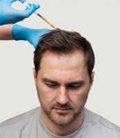 Hair Transplant Clinic in Mumbai