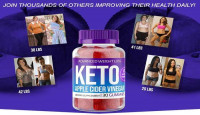 “Keto Start ACV Gummies”- Is It Worth the Money or Fake?