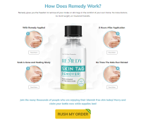 Remedy Skin Tag Remover USA ingredients & Reviews [Updated 2024]