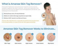 Could You at any point Trust Amarose Skin Tag Remover Serum Amazon Merchants?