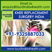 Cost of Knee Replacement Surgery India