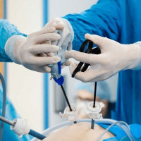 Laparoscopic surgery in Islamabad Pakistan