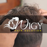 Affordable Hair Patch in Delhi – Wigy Hair Solution