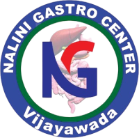 Best Gastroenterologist in Vijayawada – Nalini Gastro Center