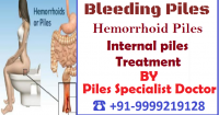 piles lady doctor in Haiderpur :: 8010931122