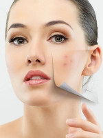Consult the Best Dermatologist in Lucknow | Advanced Skin Care