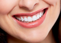 Sparkle Dental Care Pimpri Chinchwad, Pune