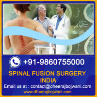 Affordable Spinal Fusion Surgery in India