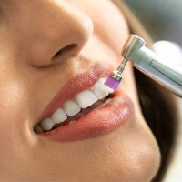 teeth scaling and polishing in Islamabad