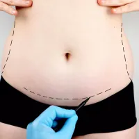 Abdominoplasty in Islamabad: The Ultimate Confidence Booster