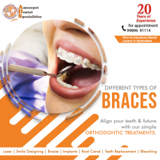 Best Dental braces treatment in Hyderabad India - ADS Dental