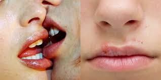Best Sexologist in India, STD Doctors in Delhi